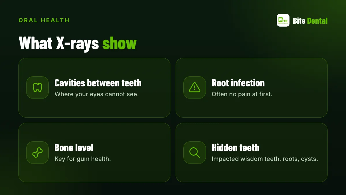 What dental X-rays show: cavities between teeth, root infection, bone level, impacted teeth